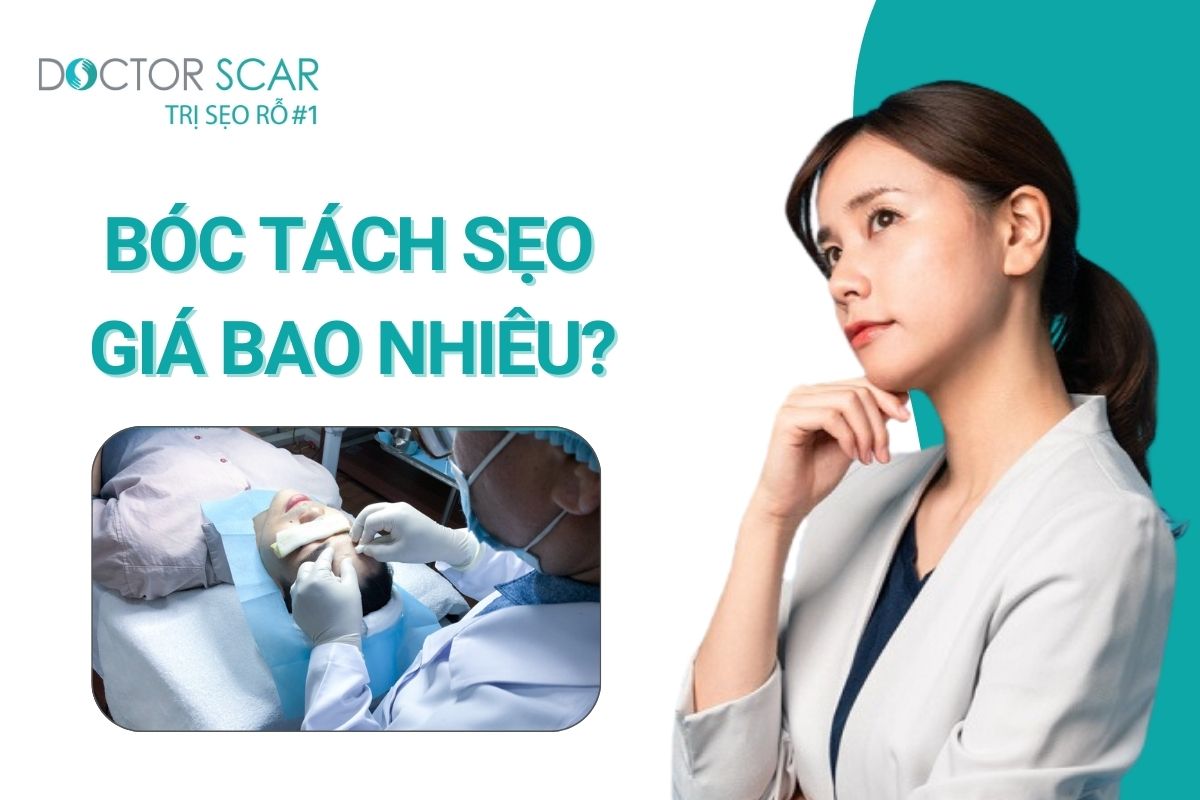 Cắt đáy sẹo rỗ giá bao nhiêu tiền? Bảng giá cắt đáy sẹo rỗ chi tiết nhất