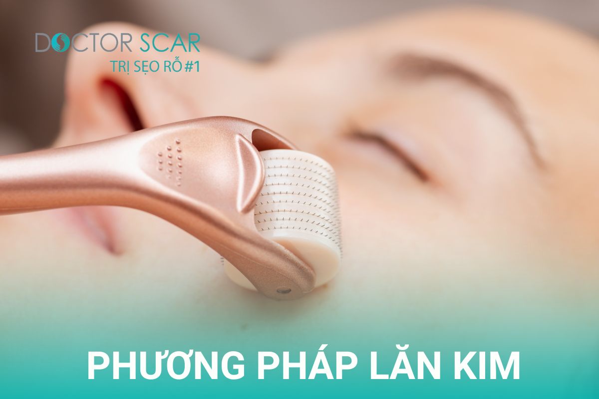 Lăn kim thực hiện bằng dụng cụ con lăn có đầu kim siêu nhỏ