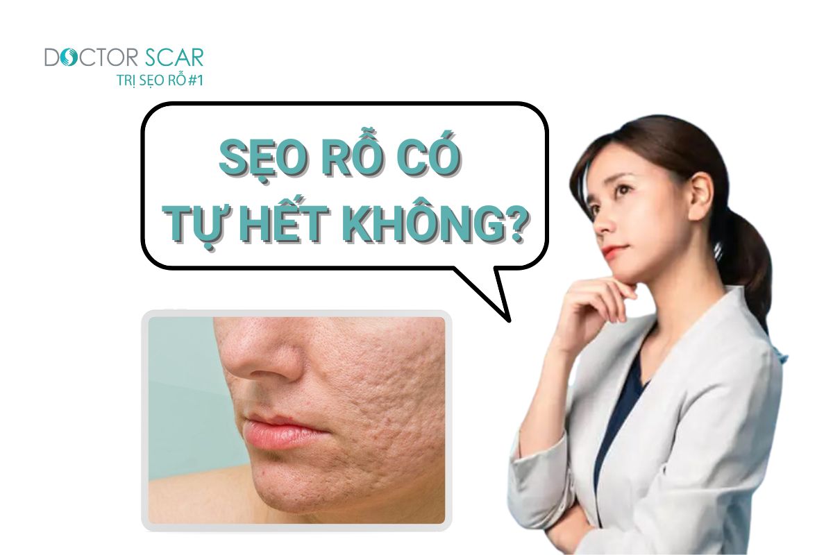 Sẹo lõm có tự đầy không? Làm sao để xóa sẹo lõm?