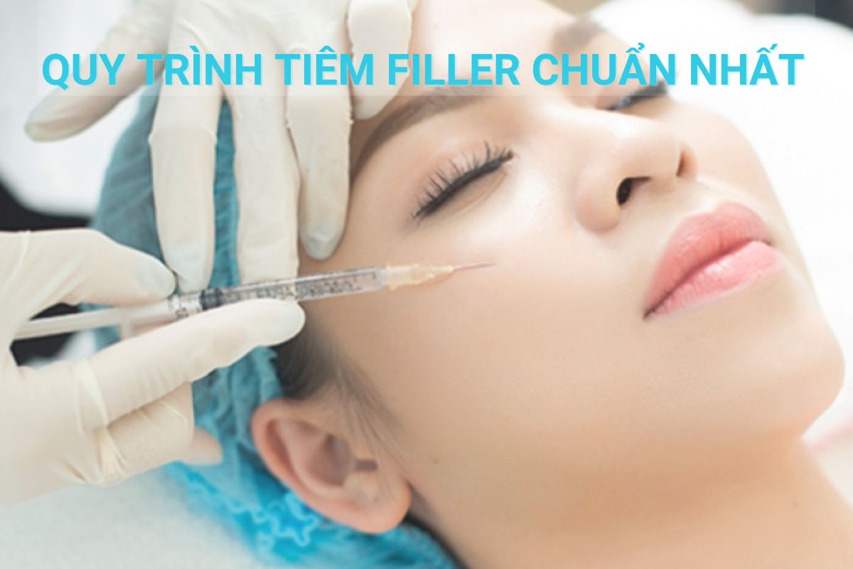 Tiêm filler được bao lâu thì tiêm lại