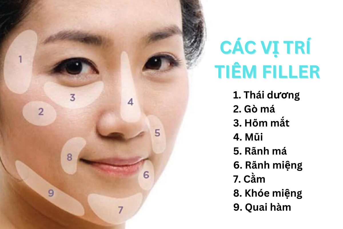 Tiêm Filler là gì? Tiêm filler bao lâu thì tan hết?