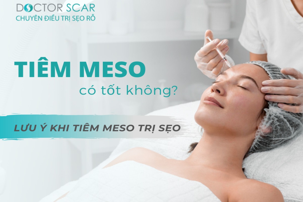 Cách tiêm Mesotherapy