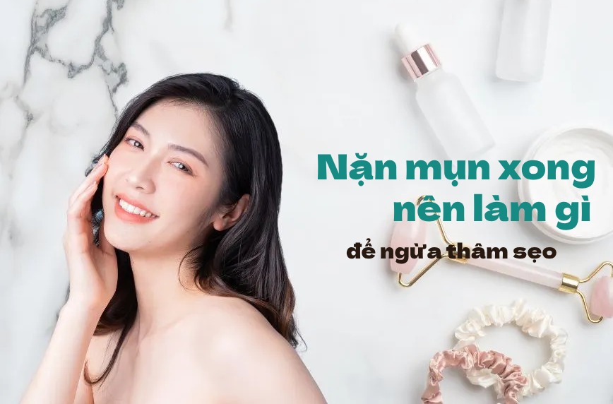 Sau khi nặn mụn nên làm gì?