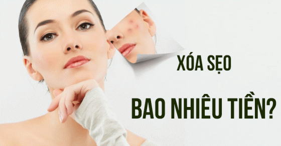 Có những rủi ro và tác động phụ nào có thể xảy ra sau phẫu thuật thẩm mỹ xóa sẹo?
