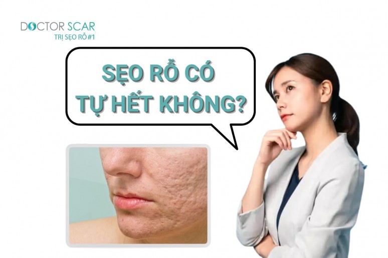 DoctorScar - Chuyên trị sẹo rỗ